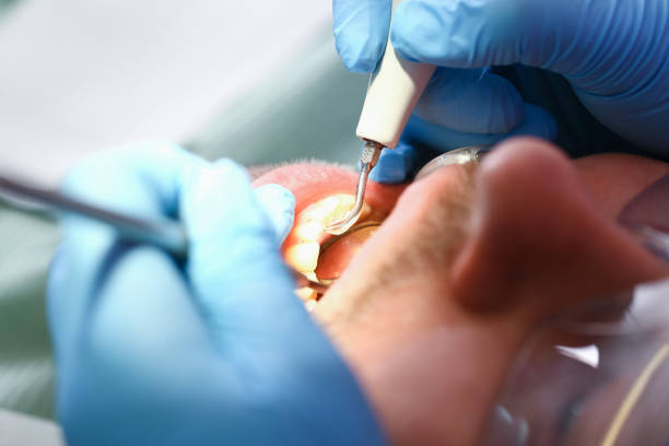 Best Emergency Dental Care for Sports Injuries in Rosedale, CA