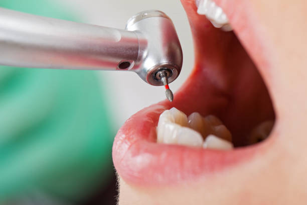 Best Walk-In Emergency Dental Services in Rosedale, CA